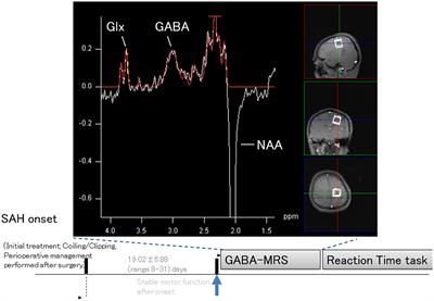 Quantitative GABA magnetic resonance spectroscopy as a measure of motor learning function in the motor cortex after subarachnoid hemorrhage